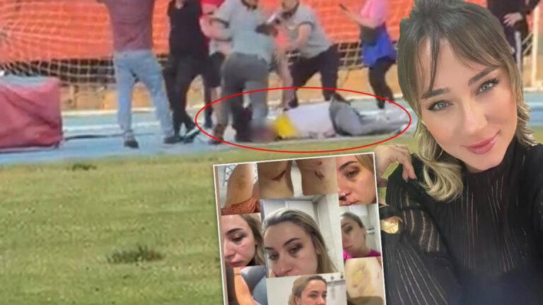 Kadın Şiddetine Karşı Tüm Yürekleri Sarsan Olay Zonguldak’ta Gerçekleşti